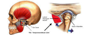 tmj injury lawyer - edmonton - temporomandibular joint dysfunction 